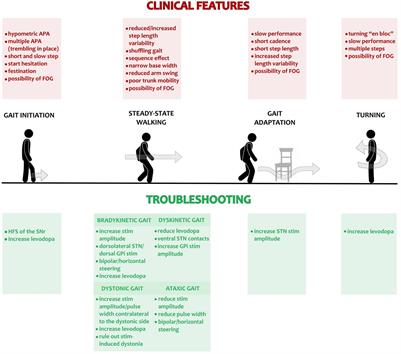 Troubleshooting Gait Disturbances in Parkinson’s Disease With Deep Brain Stimulation